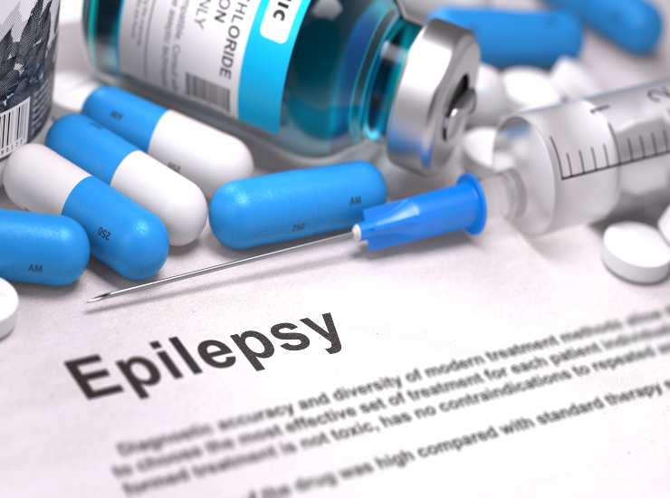 Diagnosi di epilessia